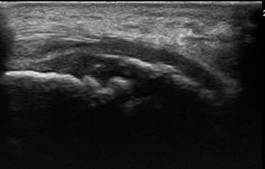 Echografisch beeld van Sever Schinz
